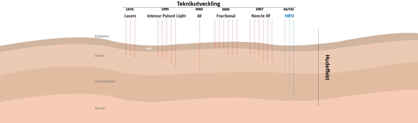 jämförelse Hifu